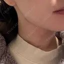 糸リフト / 脂肪吸引（顔） / 脂肪吸引（二の腕） / 脂肪吸引（脚） / 脂肪吸引（お腹） / 脂肪吸引（お尻） / 脂肪吸引（腰） / 脂肪吸引（背中） / 脂肪吸引（肩） ヴェルトラクリニック 新宿院 DAY 160 サムネイル用