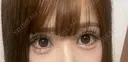 二重埋没 / 目頭切開 Stand by Beauty Clinic DAY 13 サムネイル用