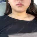 糸リフト / 脂肪吸引（顔） / ジョールファット除去 Wing clinic 豊中駅前院 DAY 4 サムネイル用