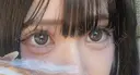 二重埋没 / 目頭切開 Stand by Beauty Clinic DAY 26 サムネイル用