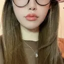 ボトックス（エラ・小顔） / ヒアルロン酸注入（唇） 目白ホワイトクリニック AFTER サムネイル用