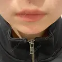 ヒアルロン酸注入（あご） R Beauty CLINIC 名古屋院 AFTER サムネイル用