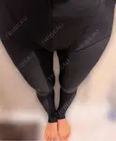 脂肪吸引（脚） / 脂肪吸引（お尻） アムルーズ美容外科クリニック 横浜院 DAY 7 サムネイル用