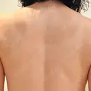 ピコフラクショナルレーザー（毛穴・ニキビ跡） ルラ美容クリニック 広島院 DAY 8 サムネイル用