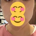 オリジオ Chloe Cheongdam Clinic （クロエチョンダムクリニック） DAY 7 サムネイル用
