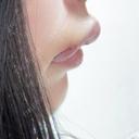 口唇縮小術 / 口角挙上 PRISM Beauty Clinic 町田院 AFTER サムネイル用