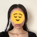 糸リフト / 脂肪吸引（顔） EMMA CLINIC（エマクリニック） DAY 32 サムネイル用