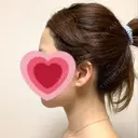 脂肪吸引（顔） R Beauty CLINIC 銀座院 DAY 12 サムネイル用