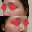 ルメッカ ルラ美容クリニック 郡山院 AFTER サムネイル用