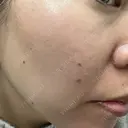 ルメッカ J CLINIC DAY 8 サムネイル用