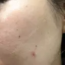 ルメッカ J CLINIC DAY 8 サムネイル用