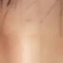 目頭切開 池袋麗歯科・美容皮膚科 DAY 0 サムネイル用