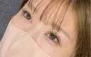 二重埋没 / 目頭切開 アリエル美容クリニック 大宮院 AFTER サムネイル用