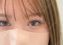 二重埋没 / 目頭切開 アリエル美容クリニック 大宮院 DAY 92 サムネイル用