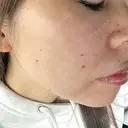 ルメッカ J CLINIC DAY 9 サムネイル用