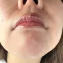 ルメッカ J CLINIC DAY 9 サムネイル用