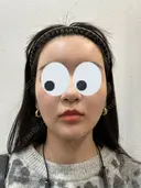 糸リフト / バッカルファット除去 / 脂肪吸引（顔） / 額を丸く / 脂肪吸引（脚） / 脂肪注入（額） / メーラーファット除去 / 脂肪注入（輪郭） First Clinic AFTER サムネイル用