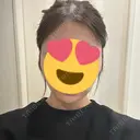 ヒアルロン酸注入（あご） HAAB BEAUTY CLINIC 名古屋院 DAY 0 サムネイル用