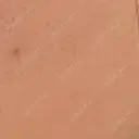 医療脱毛（顔） / 医療脱毛（うなじ） / 医療脱毛（指） / 医療脱毛（背中） 筋肉・美容クリニック DAY 14 サムネイル用