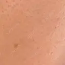 医療脱毛（顔） / 医療脱毛（うなじ） / 医療脱毛（指） / 医療脱毛（背中） 筋肉・美容クリニック AFTER サムネイル用