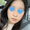 糸リフト / 脂肪吸引（顔） / 脂肪吸引注射（顔） ルラ美容クリニック 岡山院 DAY 85 サムネイル用