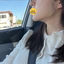 糸リフト / 脂肪吸引（顔） / 脂肪吸引注射（顔） ルラ美容クリニック 岡山院 AFTER サムネイル用