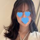 糸リフト / 脂肪吸引（顔） / 脂肪吸引注射（顔） ルラ美容クリニック 岡山院 DAY 25 サムネイル用