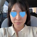 糸リフト / 脂肪吸引（顔） / 脂肪吸引注射（顔） ルラ美容クリニック 岡山院 DAY 106 サムネイル用