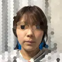 デンシティ 渋谷美容外科クリニック 横浜院 AFTER サムネイル用