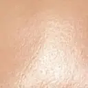 プラセンタ注射 新宿駅三丁目クリニック DAY 4 サムネイル用