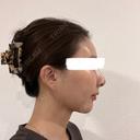 糸リフト / 脂肪吸引（顔） / 額を丸く / 脂肪注入（額） / ジョールファット除去 / 脂肪吸引注射（顔） / 脂肪注入（輪郭） / 美容点滴・美容注射（疲労回復） / その他 SEA CLINIC（シークリニック） DAY 16 サムネイル用