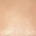 プラセンタ注射 新宿駅三丁目クリニック DAY 5 サムネイル用