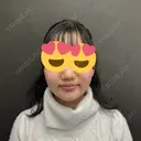 脂肪吸引（顔） ネビュラクリニック 京都院 AFTER サムネイル用