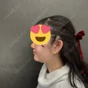 脂肪吸引（顔） ネビュラクリニック 京都院 DAY 0 サムネイル用