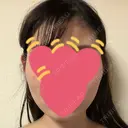 ハイフ（顔） S-Laboクリニック 渋谷院 AFTER サムネイル用