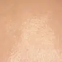 プラセンタ注射 新宿駅三丁目クリニック DAY 3 サムネイル用