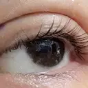 二重埋没 / 自然癒着法 形成外科と美容外科のクリニック池袋 DAY 0 サムネイル用