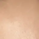 プラセンタ注射 新宿駅三丁目クリニック AFTER サムネイル用