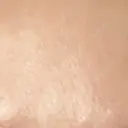 プラセンタ注射 新宿駅三丁目クリニック DAY 6 サムネイル用