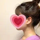 脂肪吸引（顔） R Beauty CLINIC 銀座院 DAY 14 サムネイル用