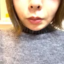 糸リフト Days Beauty Clinic 本厚木院 AFTER サムネイル用