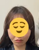 糸リフト 形成外科と美容外科のクリニック池袋 DAY 0 サムネイル用