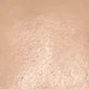 プラセンタ注射 新宿駅三丁目クリニック DAY 8 サムネイル用