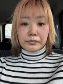 ボトックス（エラ・小顔） / ボトックス（肩） / ボトックス（首） DMTC美容皮膚科 大宮院 DAY 0 サムネイル用