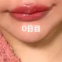 アートメイク（唇） / アートメイク（アイライン） Kinshicho Beauty Clinic （錦糸町ビューティークリニック） DAY 2 サムネイル用