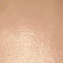 プラセンタ注射 新宿駅三丁目クリニック AFTER サムネイル用