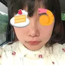 鼻尖形成（切開） / 小鼻縮小（切開） / 軟骨移植 / 眉間プロテーゼ 湘南美容クリニック 熊本院 DAY 34 サムネイル用