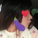 鼻尖形成（切開） / 小鼻縮小（切開） / 軟骨移植 / 眉間プロテーゼ 湘南美容クリニック 熊本院 DAY 34 サムネイル用