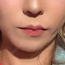 ボトックス（あご） / ボトックス（エラ・小顔） / ボトックス（口角） / ボトックス（人中） DMTC CLINIC 渋谷院 AFTER サムネイル用