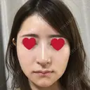 骨切り（あご） / 骨削り（エラ） / 骨削り（頬） / その他（輪郭） RG整形外科（旧リオン整形外科） DAY 10 サムネイル用